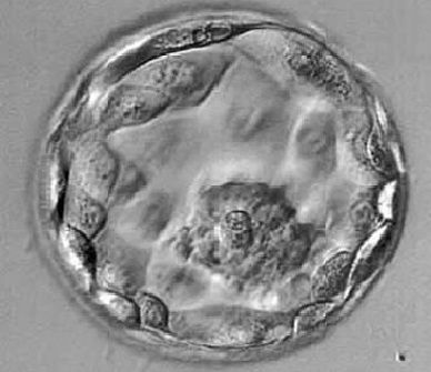 Blastocyst-Transfer.jpg