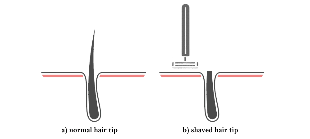 normal-vs-shaved-hair.gif