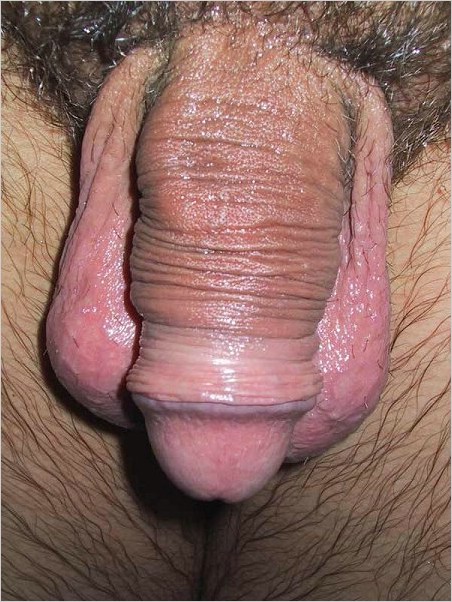 foreskin-shower.jpg