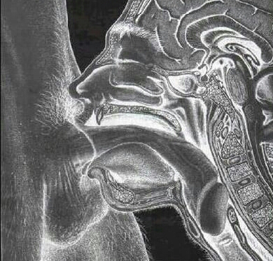 Throatfuck x-ray swallow-1.jpg